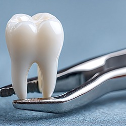 It may seem less expensive to extract an infected tooth, but replacing it with a prosthetic could make this the costlier option